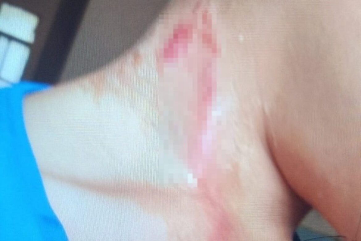 policia-investiga-caso-de-crianca-agredida-a-varadas-pelo-pai;-suspeito-impedia-menino-de-ir-a-escola-para-que-ferimentos-nao-fossem-vistos