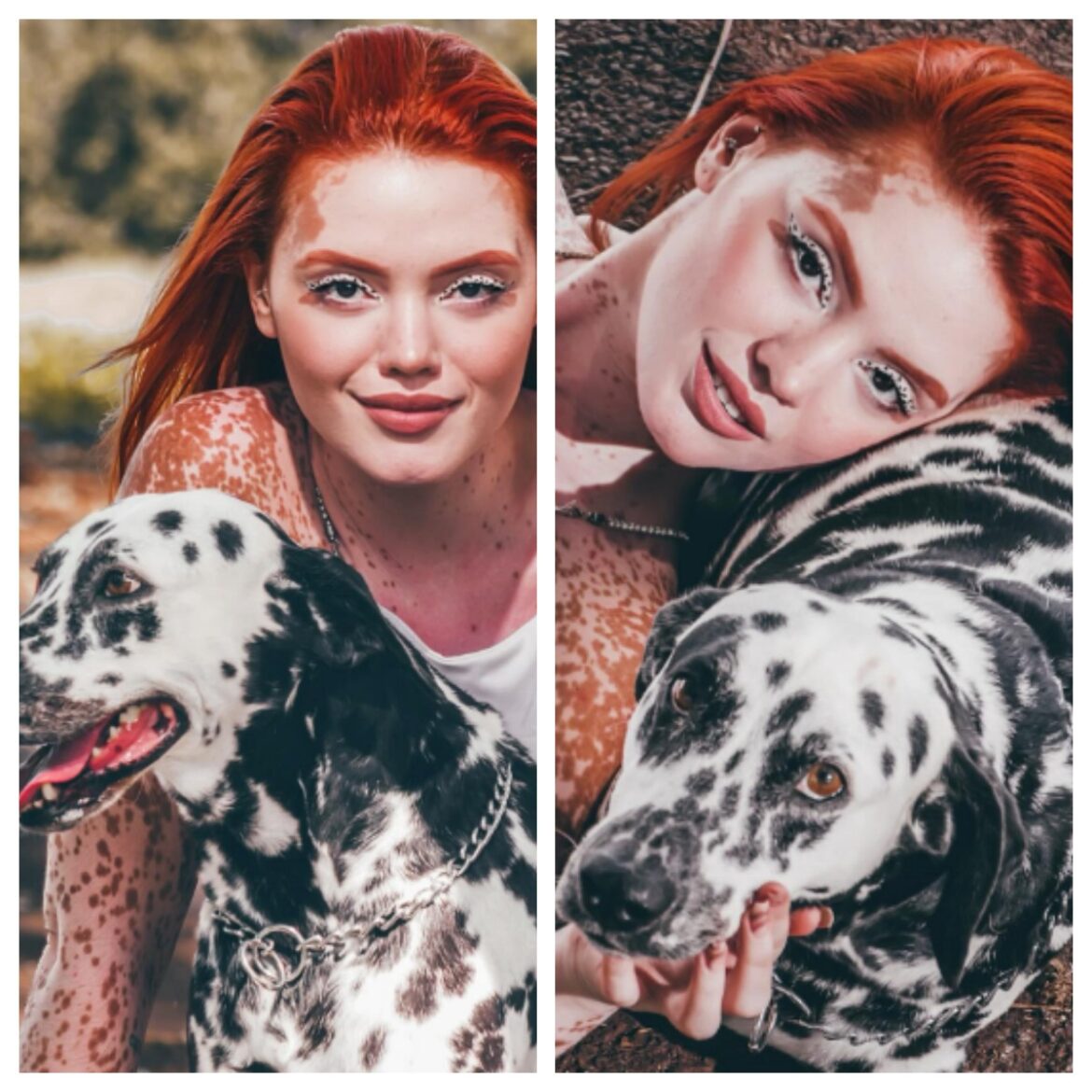 vitiligo-x-tom-de-pele:-influencer-com-mesma-doenca-do-michael-jackson-teve-dificuldade-para-se-identificar-racialmente;-entenda