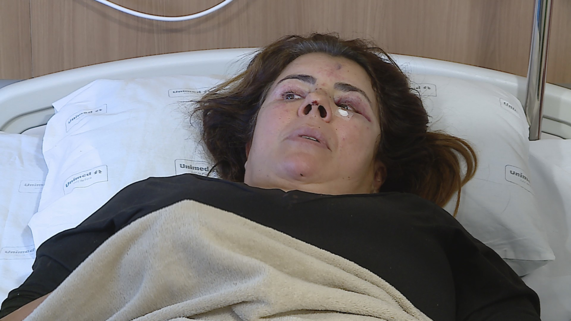 ‘foi-muito-chute-na-cabeca-e-no-torax’:-medica-agredida-por-paciente-em-juiz-de-fora-teve-traumatismo-craniano