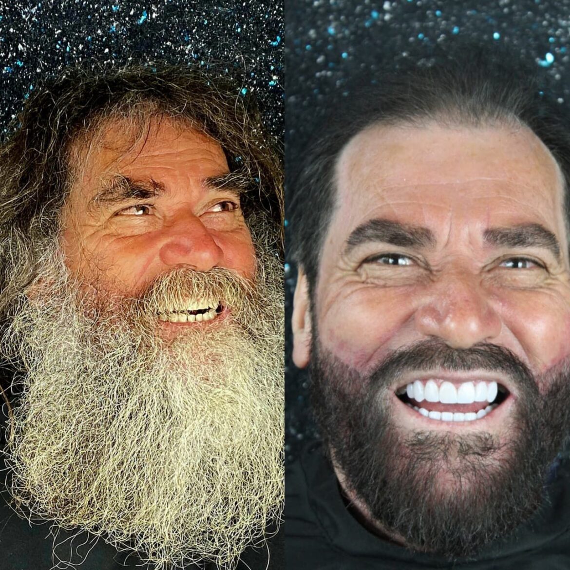 homem-ganha-transformacao-completa-apos-ganhar-tratamento-dentario-de-r$-15-mil-no-interior-de-sp