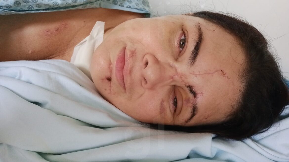 ‘ouvi-medicos-dizer-que-eu-nao-ia-mais-reagir’,-diz-mulher-que-ficou-em-coma-apos-agressao-do-ex
