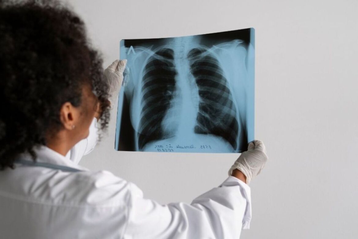 com-aumento-de-casos-registrados,-brasil-nao-atinge-meta-da-oms-para-reduzir-casos-de-tuberculose